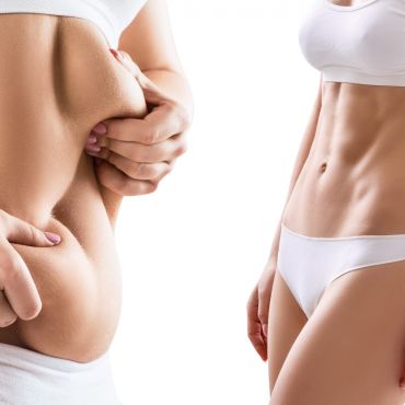 Điêu khắc Bụng Eo SLine